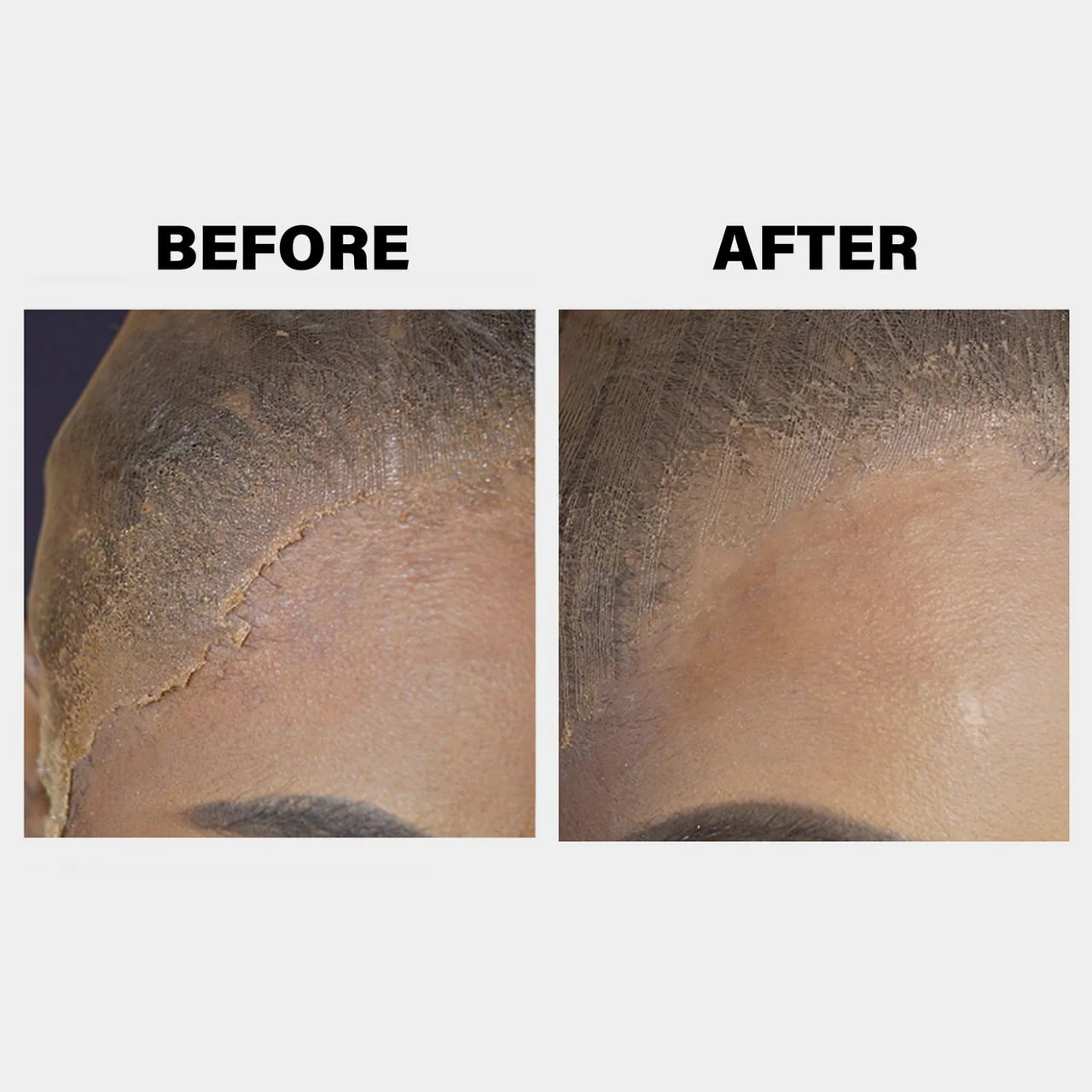 Before shows a visible lace edge with flaky residue; After shows the seamless melt with EBIN Wonder Lace Bond spray.